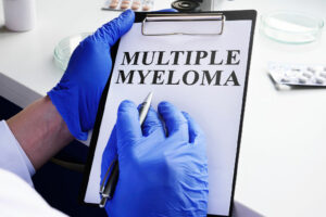 Multiple Myeloma – Symptoms, and Management Tips